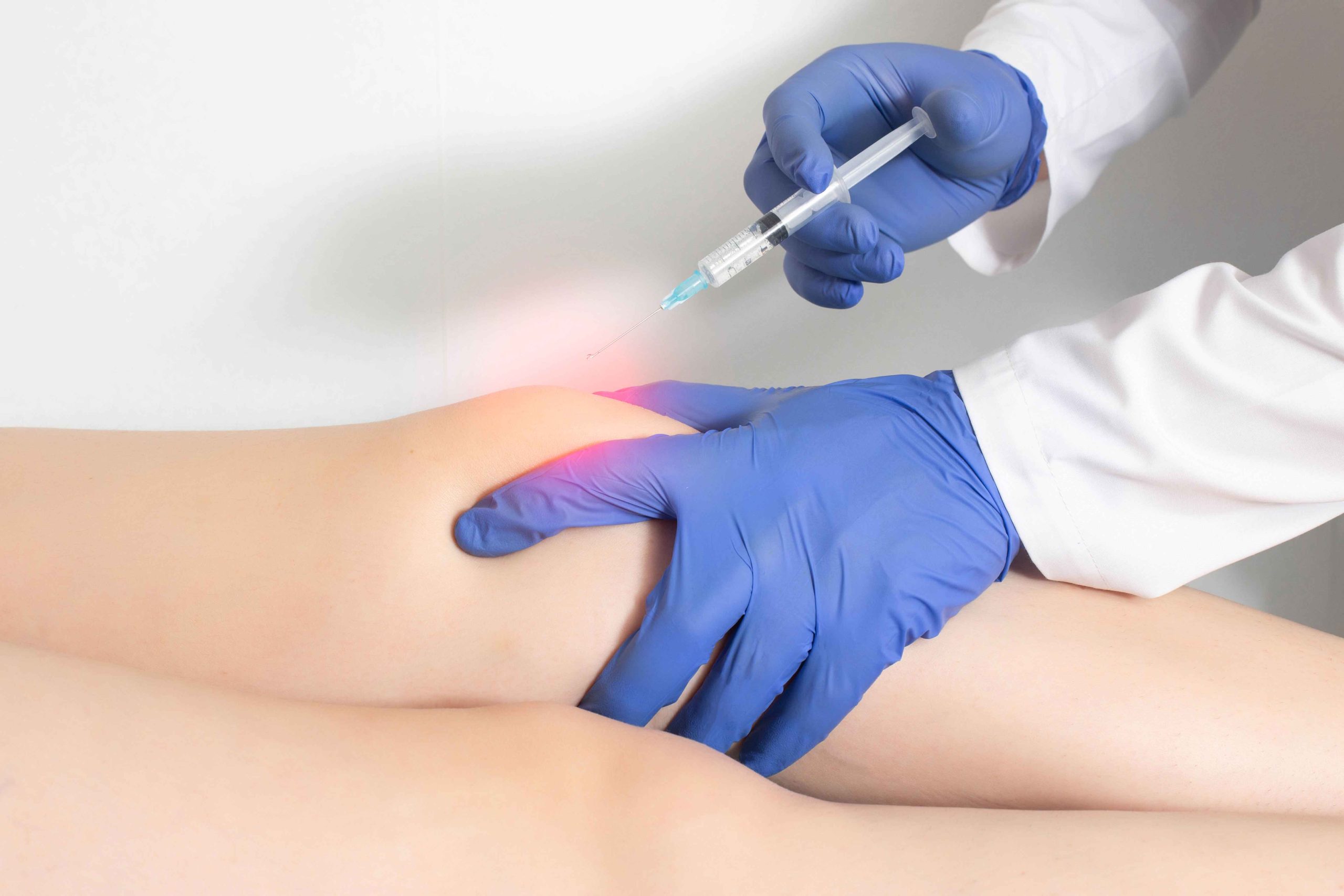 Prolotherapy injection Treatment